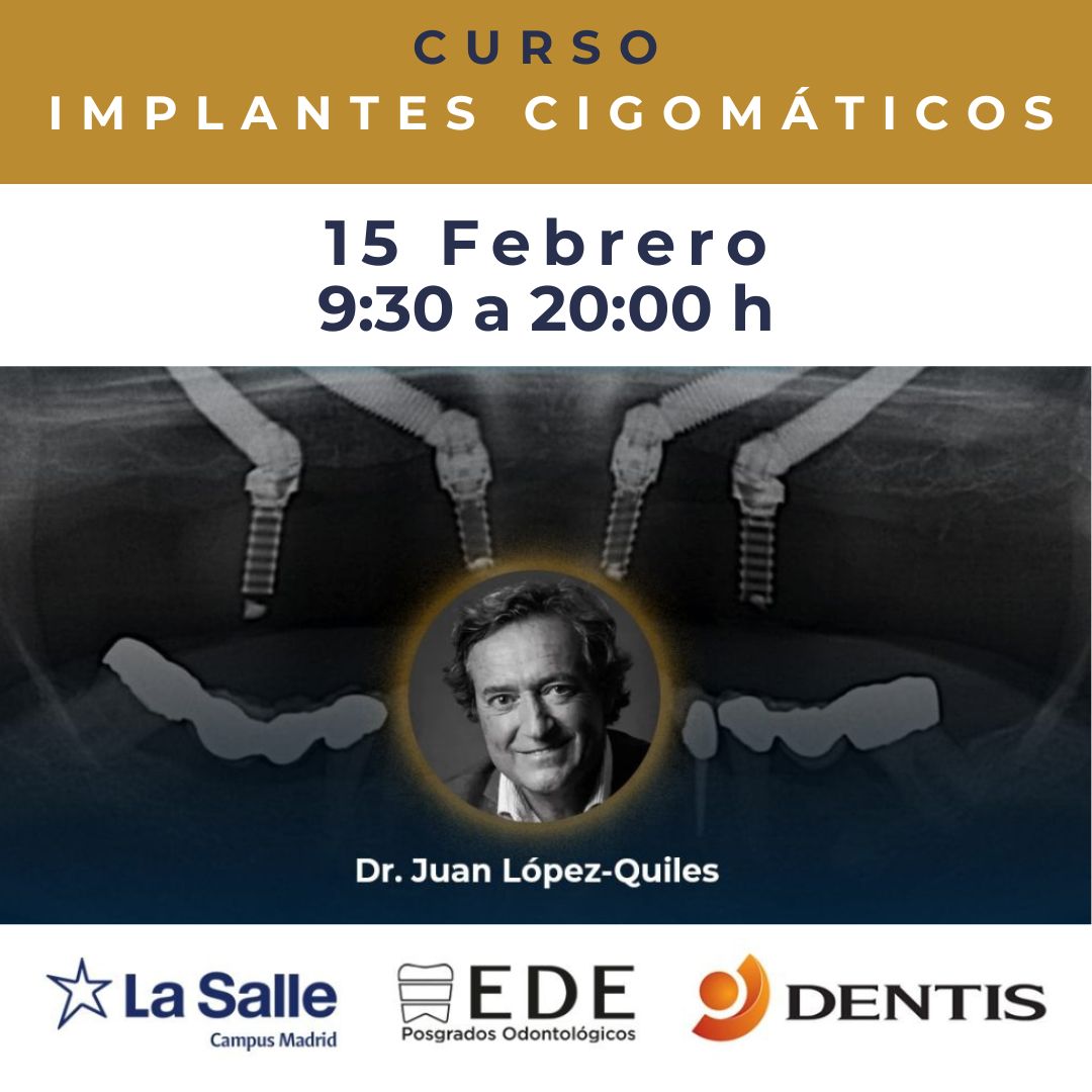 Curso de Implantes Cigomáticos 15/02/2025