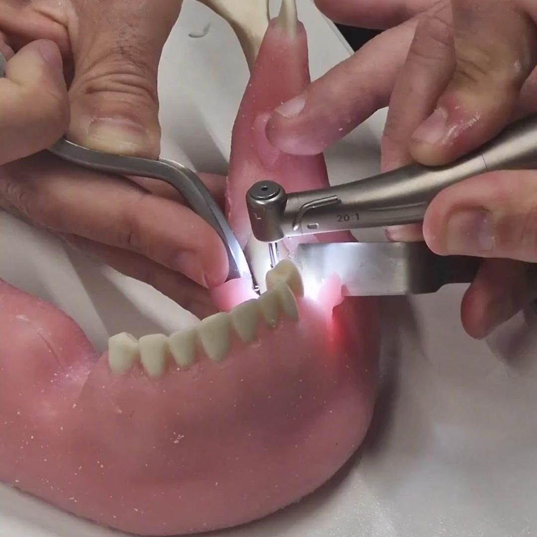 Curso Taller Sistema Implantes SQ 10/01/2025